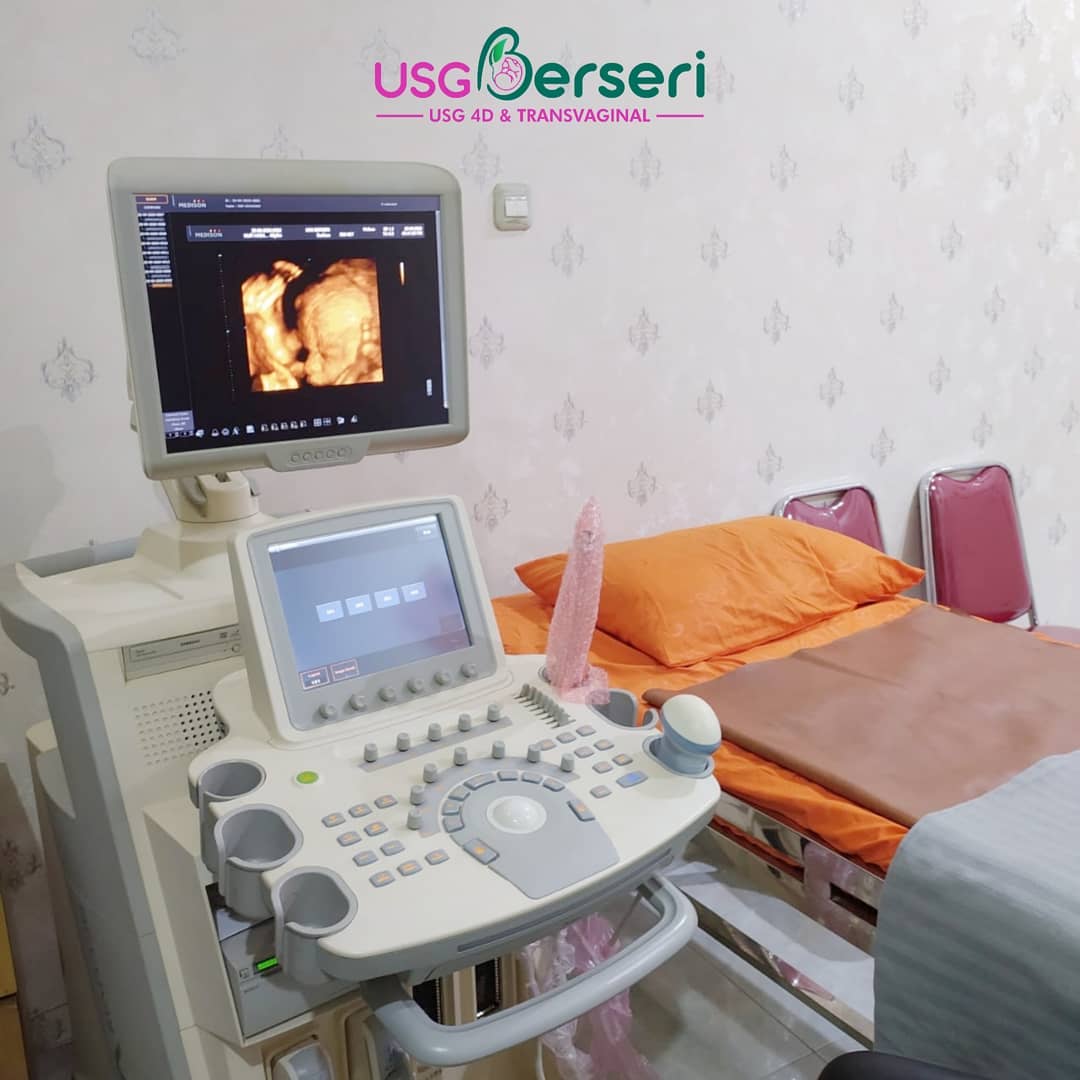 USG 4D murah jakarta barat